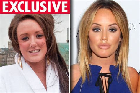 geordie shore plastic surgery